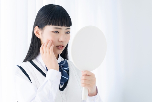 ニキビができている時のスキンケア、どこまでやればいい?